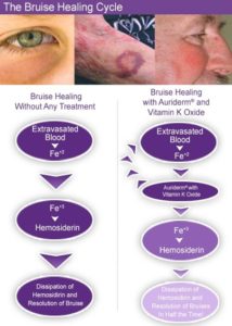 Bruise Healing Chart at Dignity Medical