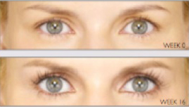 eye-rejuv06